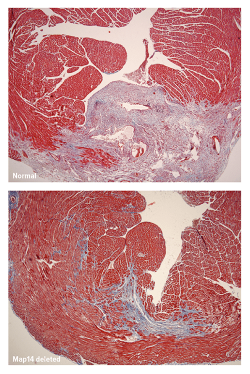 These histological images, generated at 28 days post-ischemic injury, show markedly reduced fibrosis in mice with the deleted gene (bottom). Blue staining indicates fibrosis.